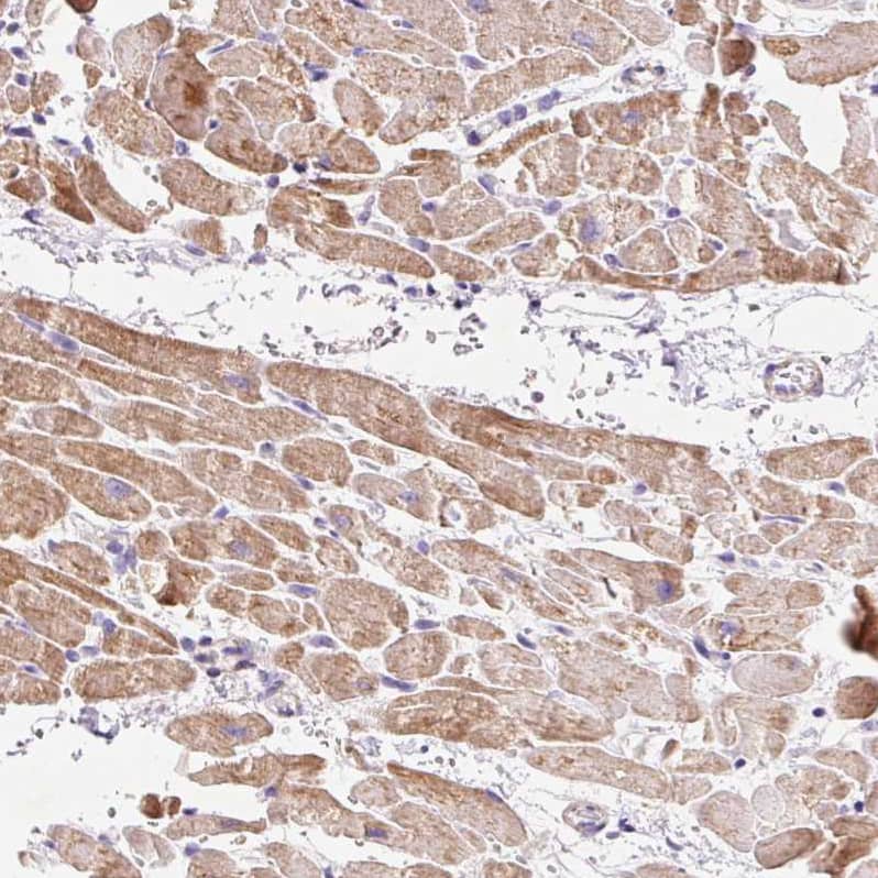 Staining of human heart muscle shows moderate granular cytoplasmic positivity in cardiomyocytes.