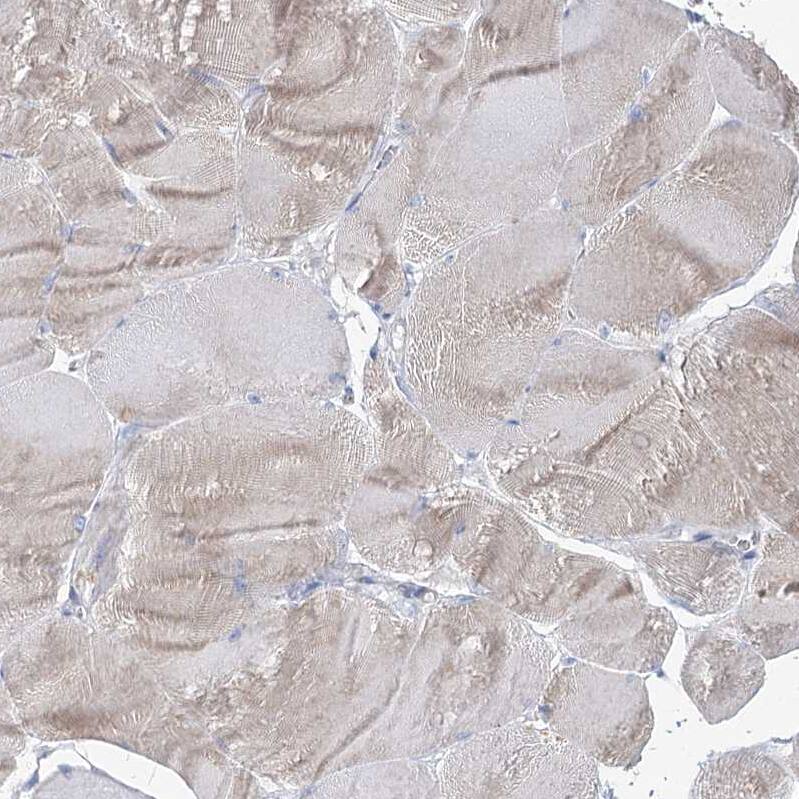 Immunohistochemistry-Paraffin IGSF3 Antibody - BSA Free
