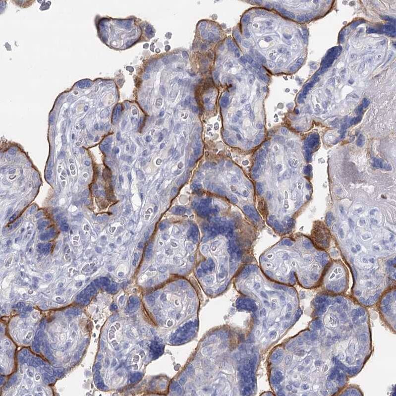 Immunohistochemistry-Paraffin IGSF3 Antibody - BSA Free