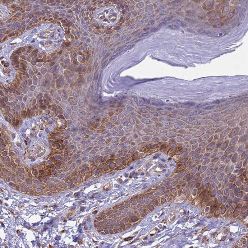 Staining of human skin shows moderate to strong membranous positivity in keratinocytes.