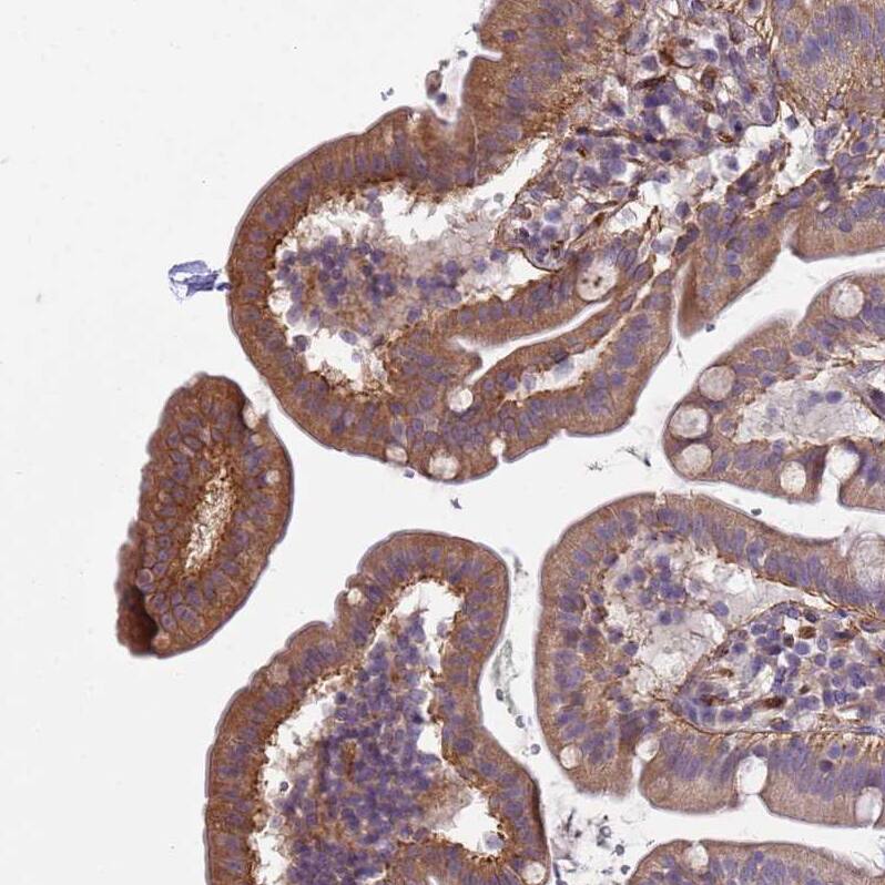 Staining of human duodenum shows moderate to strong membranous positivity in glandular cells.