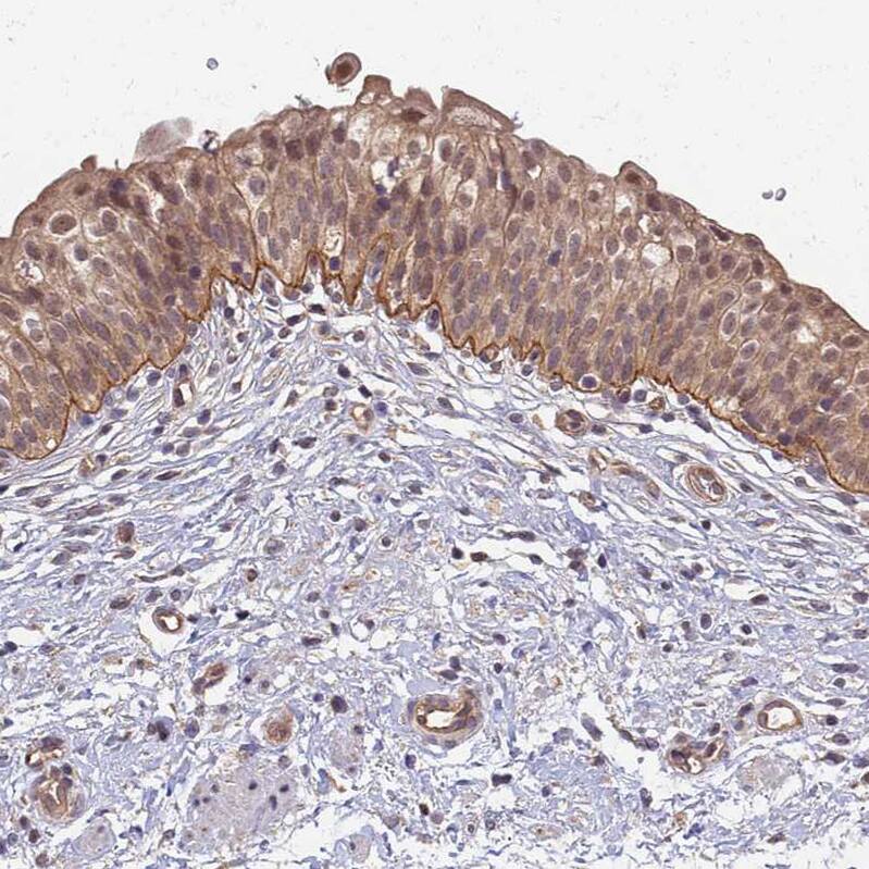 <b>Independent Antibodies Validation. </b>Staining of human urinary bladder shows moderate membranous positivity in urothelial cells.