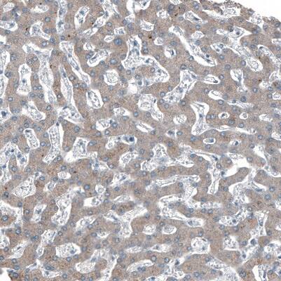 Staining of human liver shows weak positivity in hepatocytes as expected.