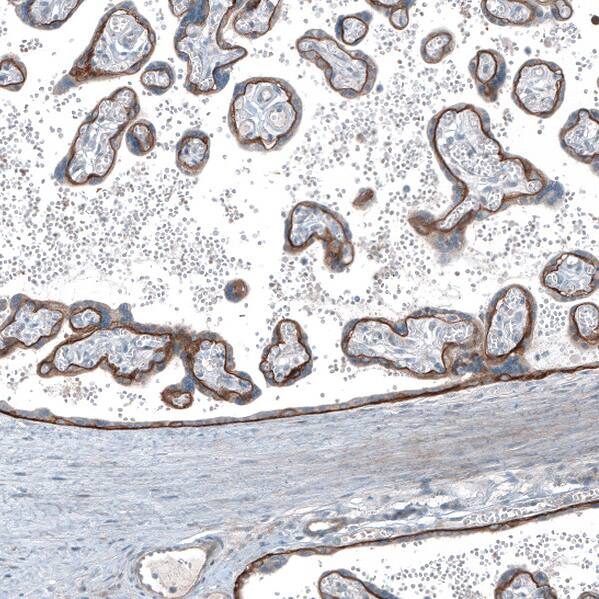 Staining of human placenta shows strong membranous positivity in trophoblastic cells.