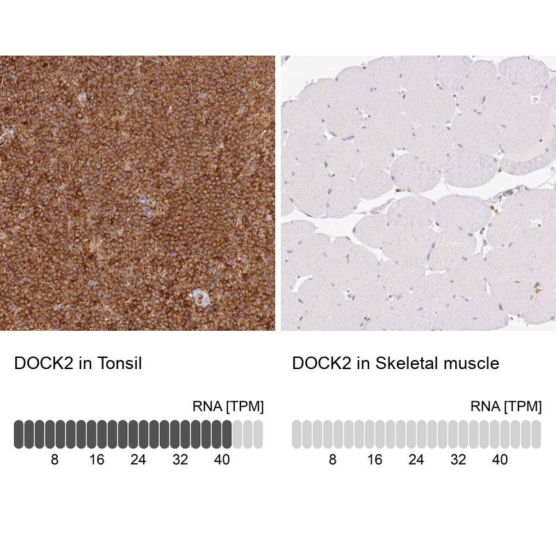 Immunohistochemistry-Paraffin DOCK2 Antibody - BSA Free