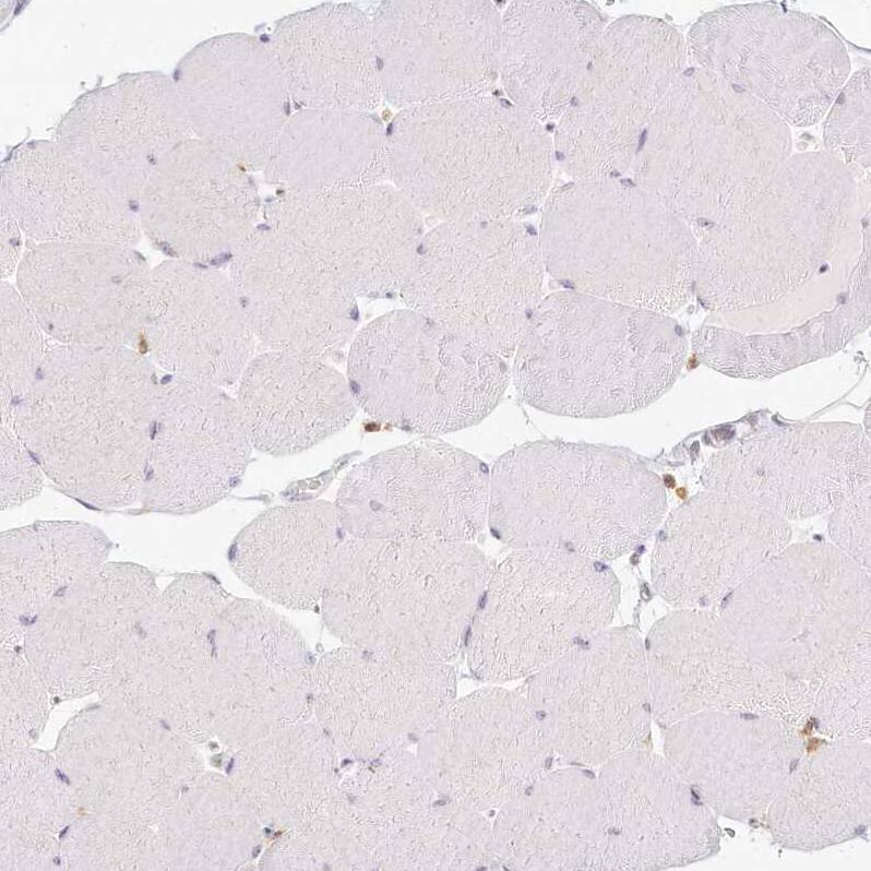 Immunohistochemistry-Paraffin DOCK2 Antibody - BSA Free