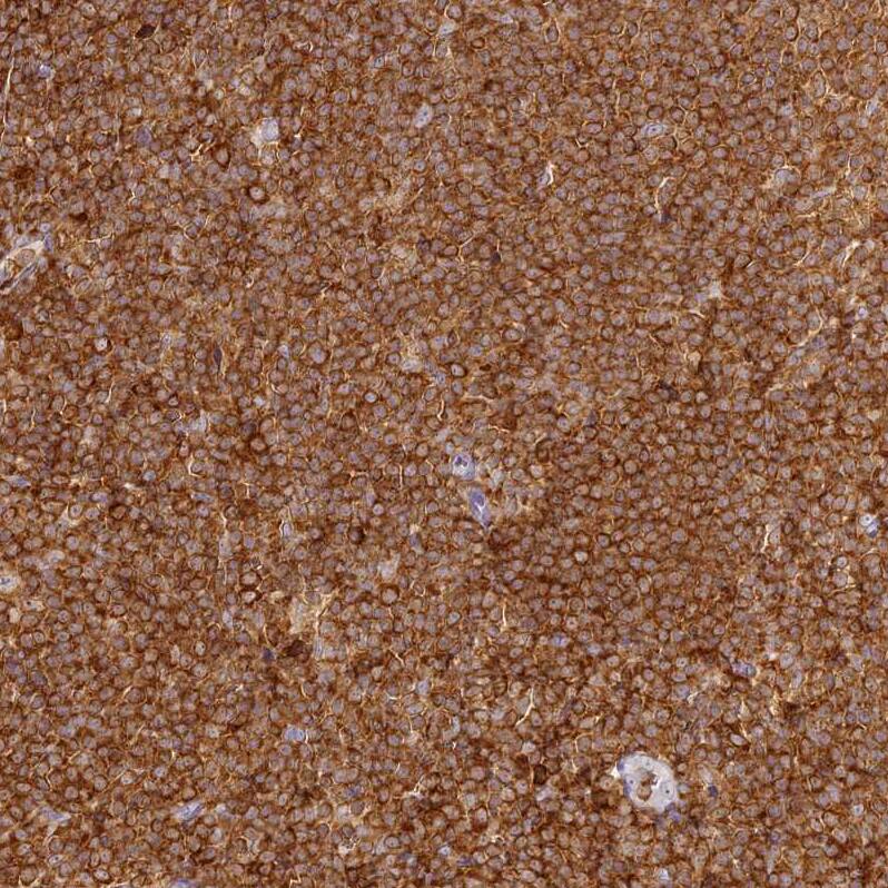 Immunohistochemistry-Paraffin DOCK2 Antibody - BSA Free