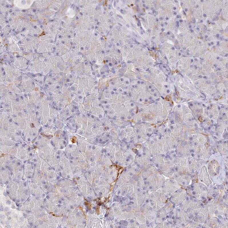 Immunohistochemistry-Paraffin DOCK2 Antibody - BSA Free