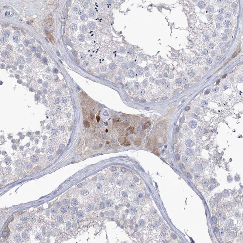 Staining of human testis shows cytoplasmic positivity in Leydig cells.