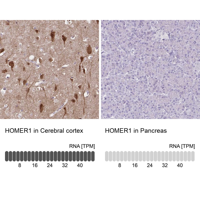 Immunohistochemistry-Paraffin HOMER1 Antibody - BSA Free