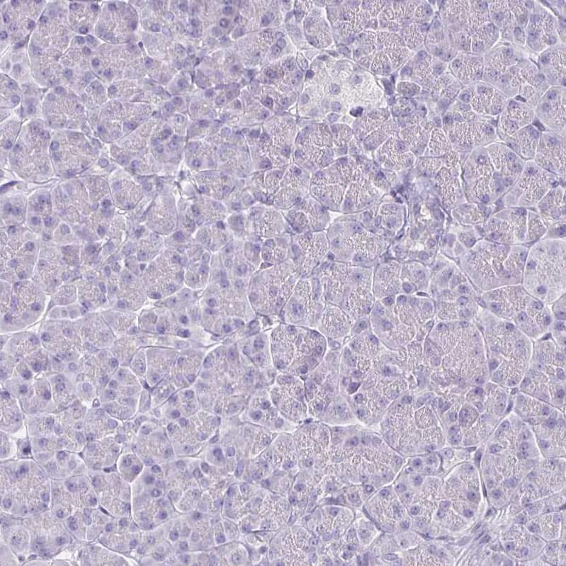 Immunohistochemistry-Paraffin HOMER1 Antibody - BSA Free