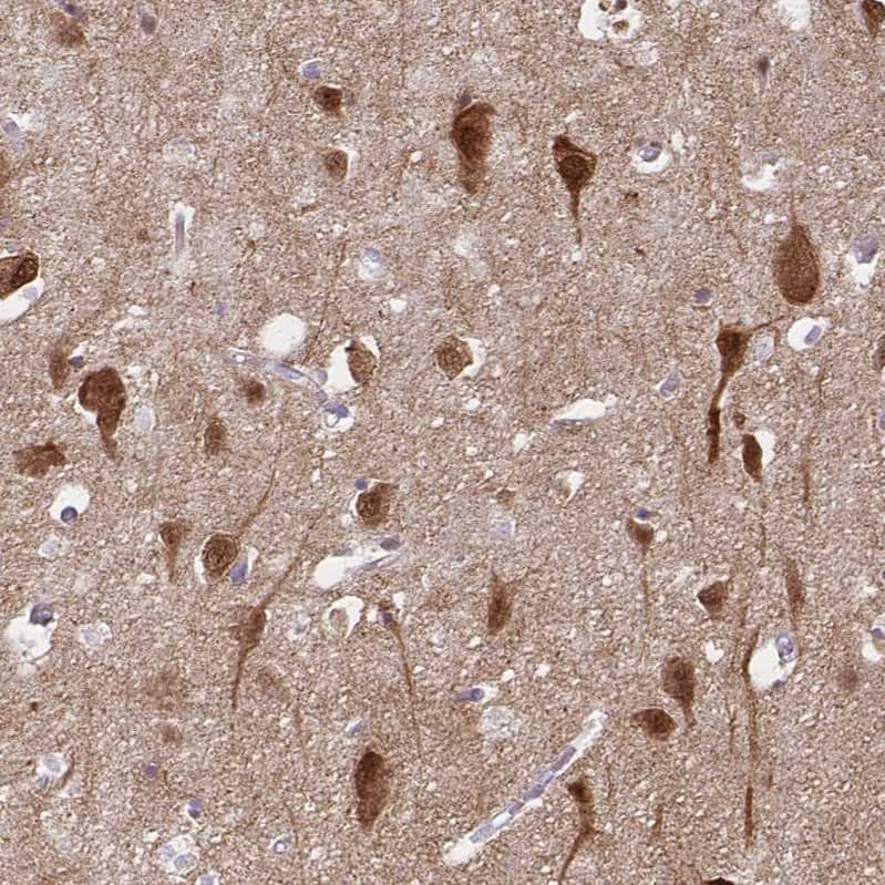 Immunohistochemistry-Paraffin HOMER1 Antibody - BSA Free