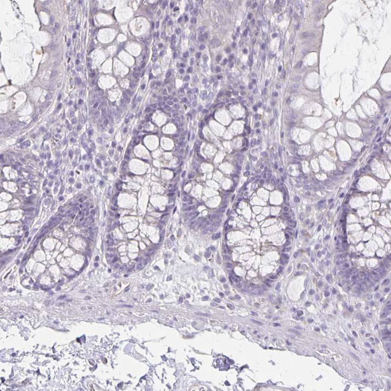 Immunohistochemistry-Paraffin HOMER1 Antibody - BSA Free