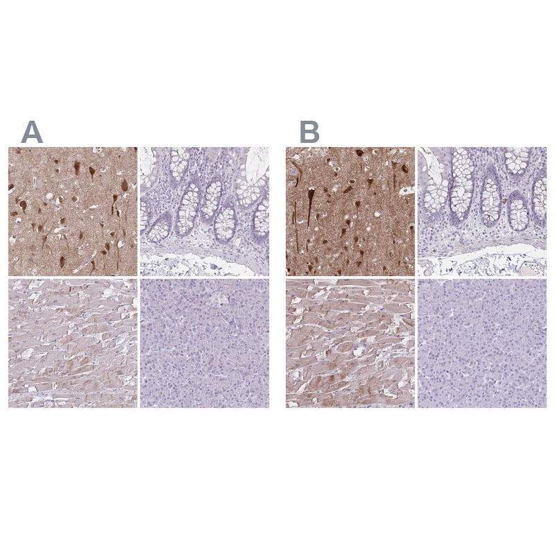Immunohistochemistry-Paraffin HOMER1 Antibody - BSA Free