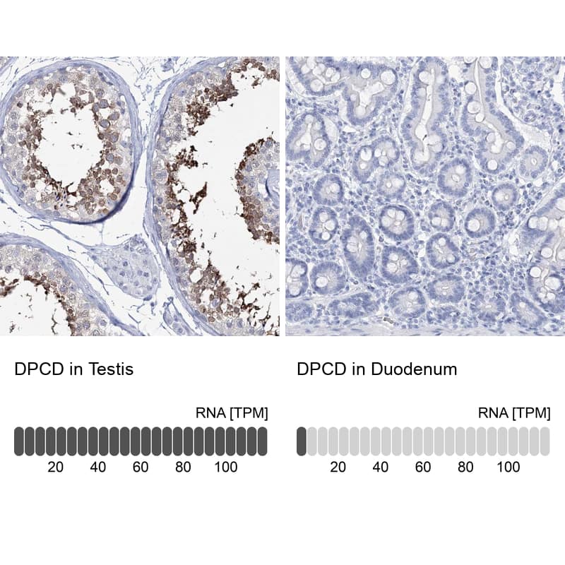<b>Orthogonal Strategies Validation. </b>Analysis in human testis and duodenum tissues.