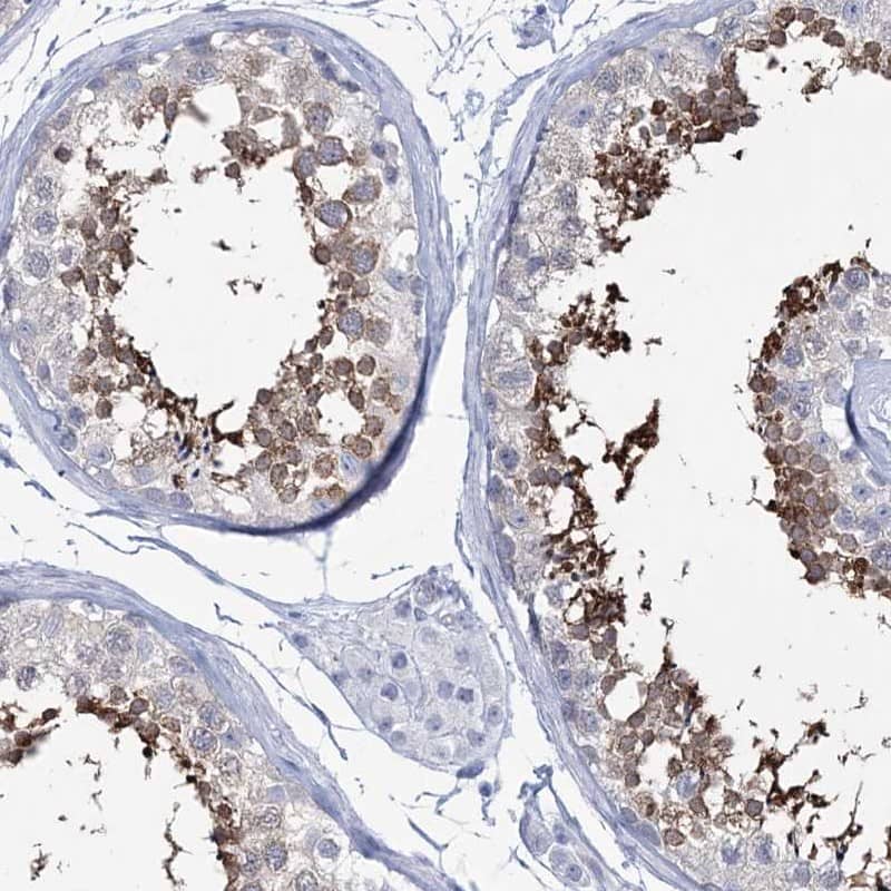 Staining of human testis shows high expression.