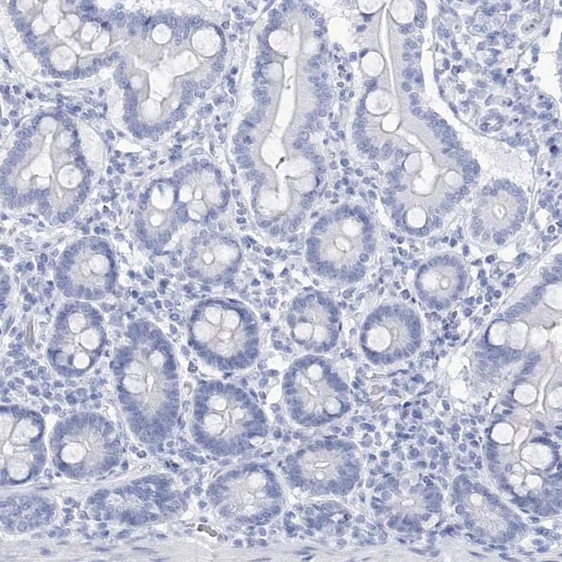 Staining of human duodenum shows low expression as expected.