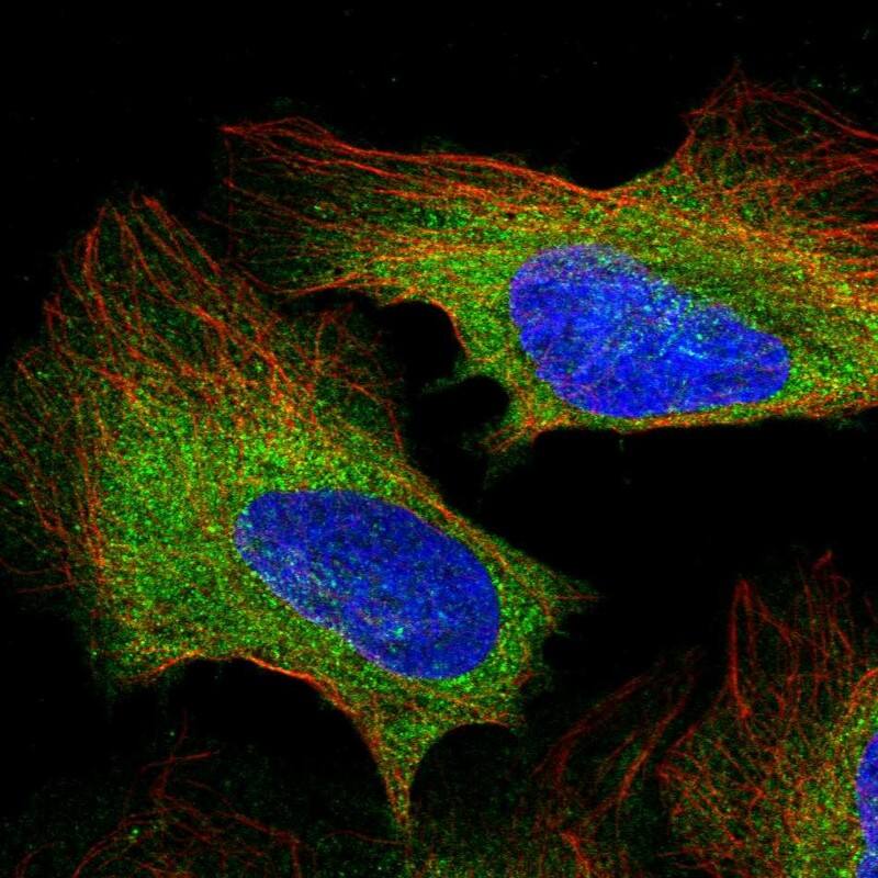 Staining of human cell line U-2 OS shows localization to cytosol.