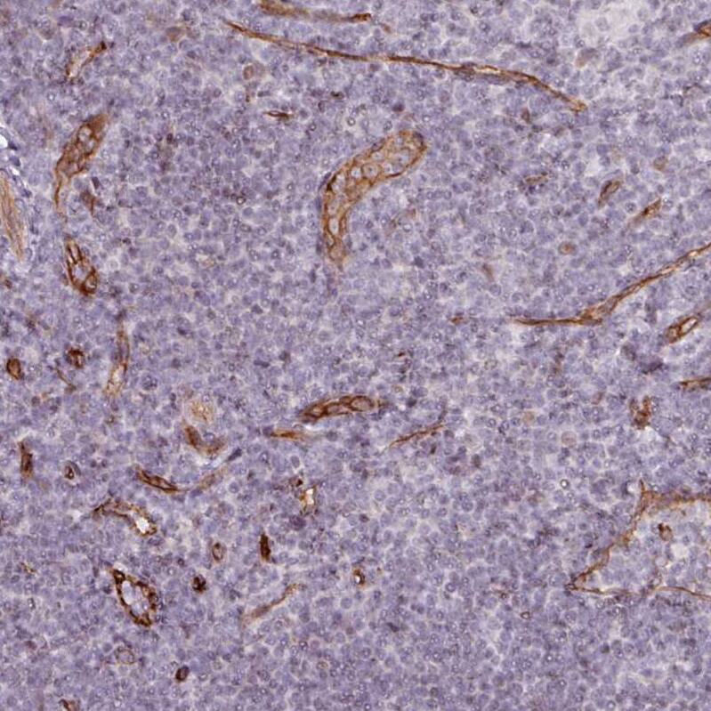 Staining of human lymphoid tissues shows moderate to strong membranous positivity in endothelial cells.