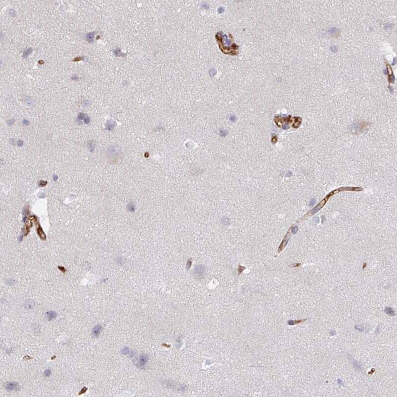 Staining of human cerebral cortex shows moderate membranous positivity in endothelial cells and very weak cytoplasmic positivity in neurons.