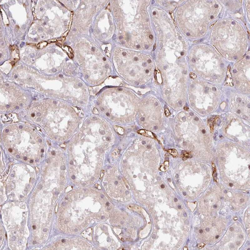 Staining of human kidney shows moderate membranous positivity in endothelial cells.