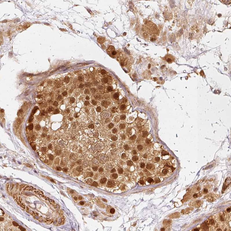 Immunohistochemistry-Paraffin Rpn2 Antibody - BSA Free