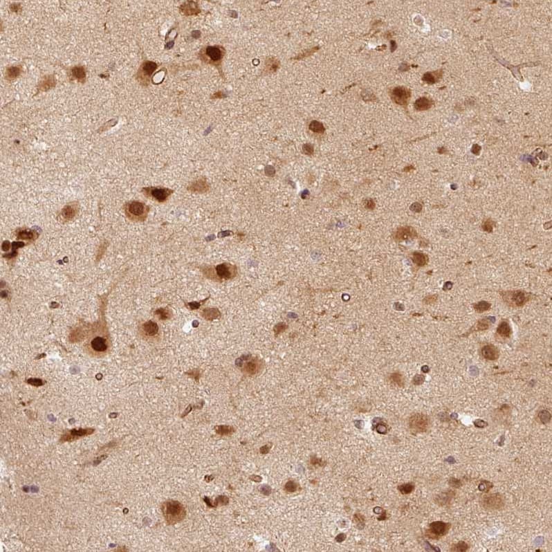 Staining of human cerebral cortex shows strong nuclear positivity in neurons.