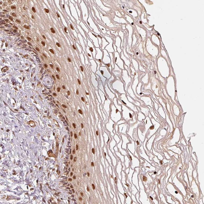 Staining of human cervix, uterine shows strong nuclear positivity in squamous epithelial cells.
