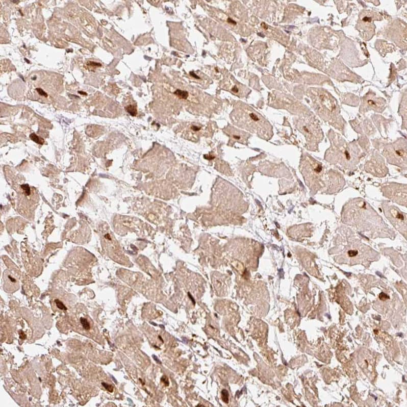 Staining of human heart muscle shows strong nuclear positivity in cardiomyocytes.
