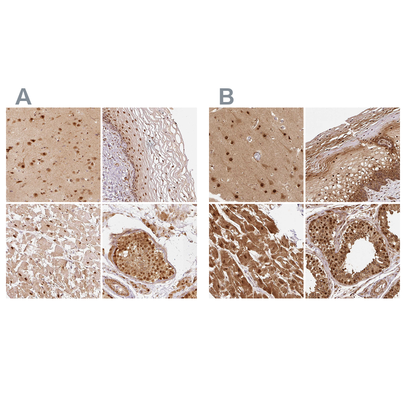 Staining of human cerebral cortex, cervix, uterine, heart muscle and testis HPA036736 (A) shows similar protein distribution across tissues to independent antibody HPA036737 (B).