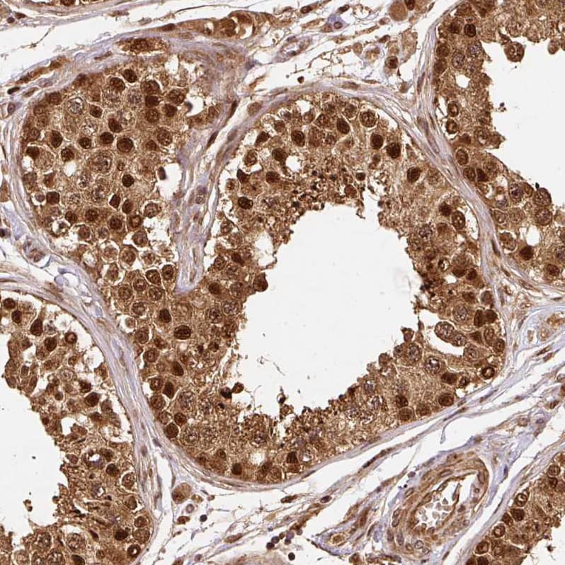 Staining of human testis shows strong nuclear positivity in cells in seminiferous ducts.