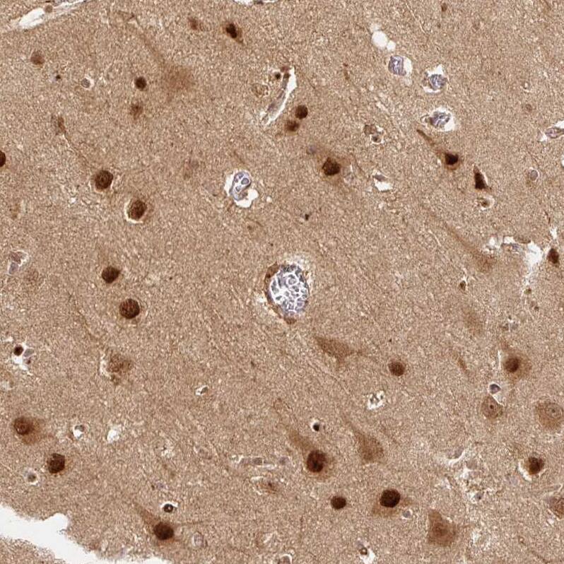 Staining of human cerebral cortex shows strong nuclear positivity in neurons.