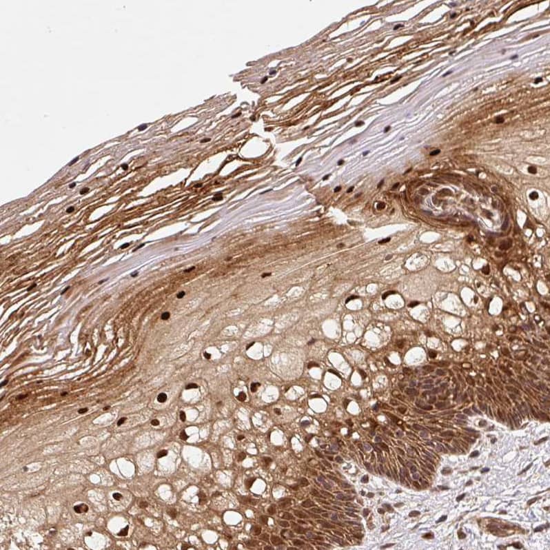 Staining of human cervix, uterine shows strong nuclear positivity in squamous epithelial cells.