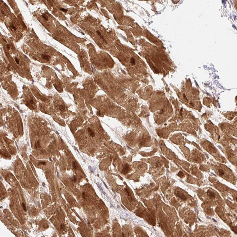 Staining of human heart muscle shows strong nuclear and cytoplasmic positivity in cardiomyocytes.