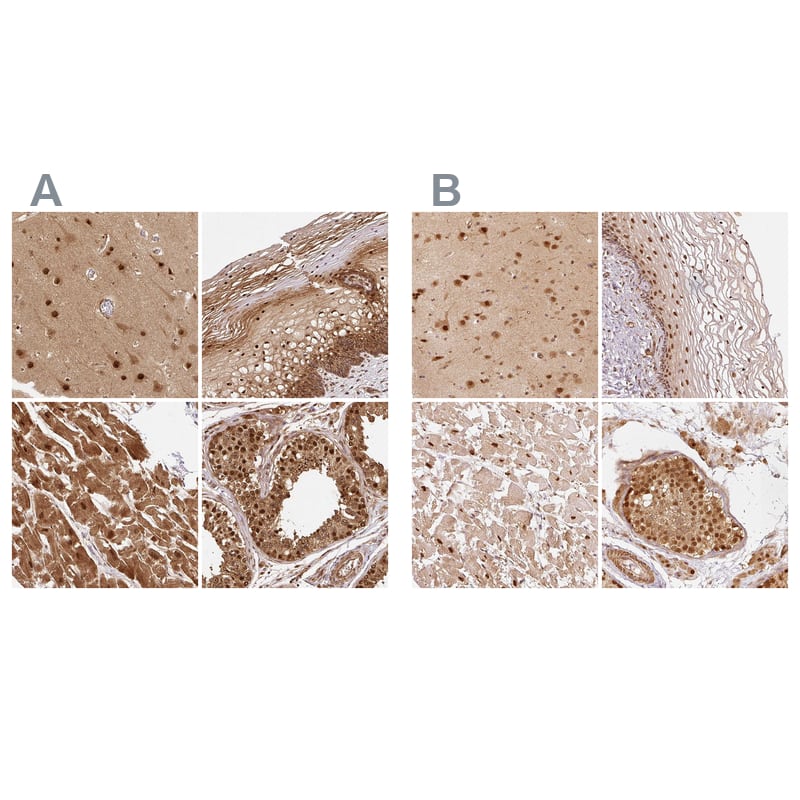 <b>Orthogonal Strategies Validation. </b>Staining of human cerebral cortex, cervix, uterine, heart muscle and testis HPA036737 (A) shows similar protein distribution across tissues to independent antibody HPA036736 (B).