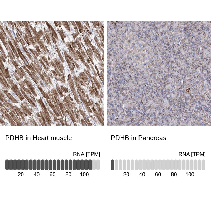 <b>Orthogonal Strategies Validation. </b>Analysis in human heart muscle and pancreas tissues. Corresponding RNA-seq data are presented for the same tissues.