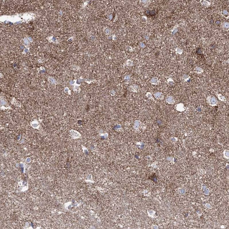 Staining of human cerebral cortex shows moderate positivity in neuropil.