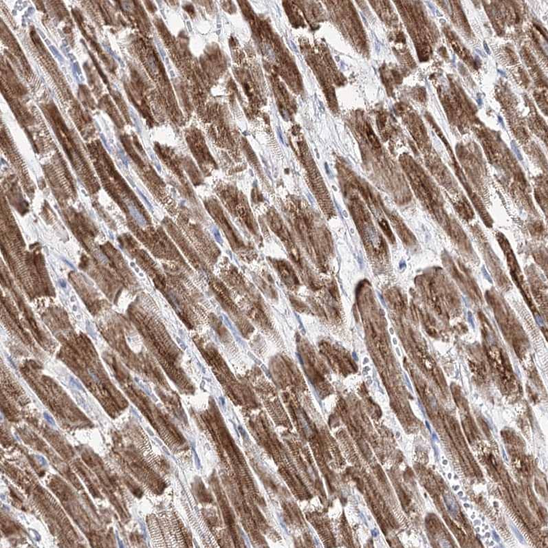 Staining of human heart muscle shows strong cytoplasmic positivity in cardiomyocytes.