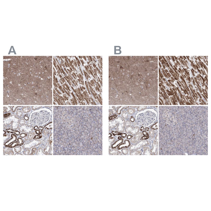 <b>Orthogonal Strategies Validation. </b>Staining of human cerebral cortex, heart muscle, kidney and pancreas HPA036745 (A) shows similar protein distribution across tissues to independent antibody HPA036744 (B).