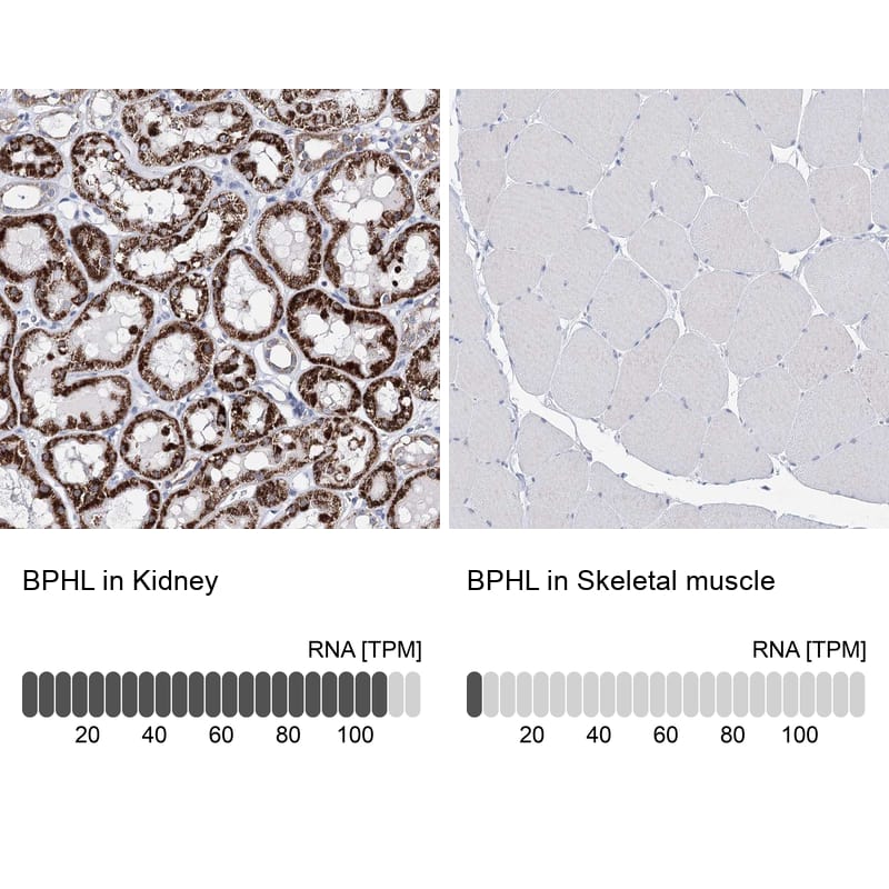 <b>Orthogonal Strategies Validation. </b>Analysis in human kidney and skeletal muscle tissues.