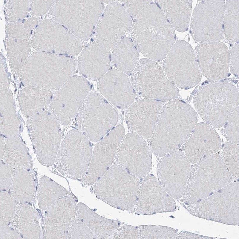Staining of human skeletal muscle shows low expression as expected.