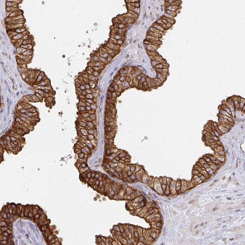 Staining of human prostate shows strong cytoplasmic and membranous positivity in glandular cells.