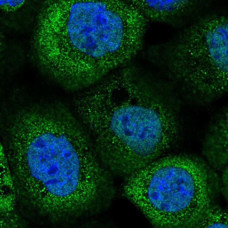 Staining of human cell line A-431 shows localization to nucleoplasm & cytosol.