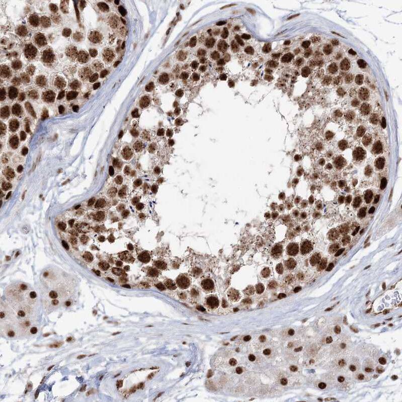 Staining of human testis shows strong nuclear positivity in cells in seminiferous ducts.