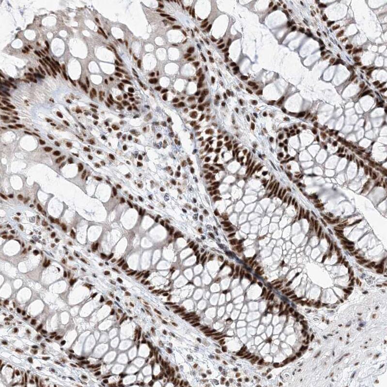 Staining of human colon shows strong nuclear positivity in glandular cells.