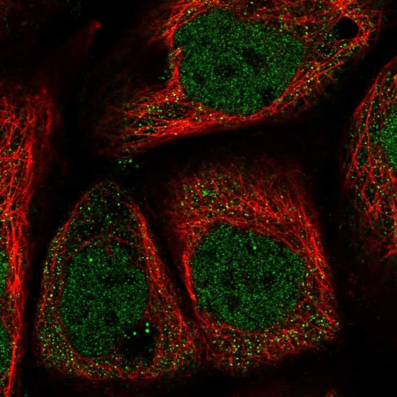 Staining of human cell line A-431 shows localization to nucleoplasm.