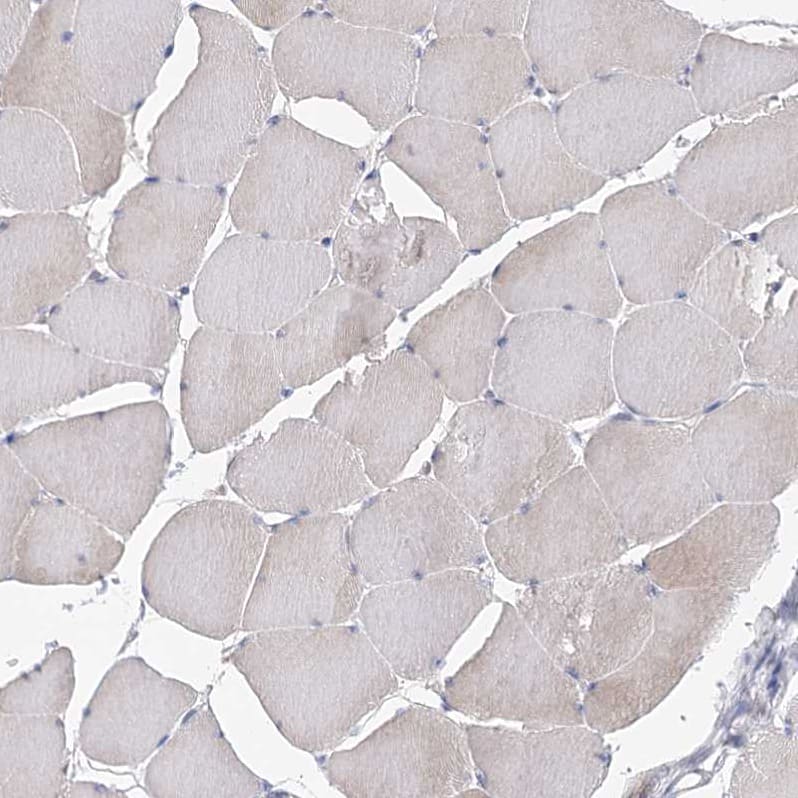 Staining of human skeletal muscle shows very weak positivity in myocytes.
