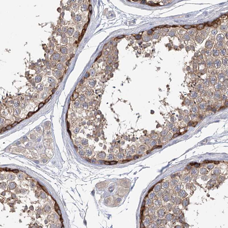 Staining of human testis shows strong cytoplasmic positivity in cells in seminiferous ducts.