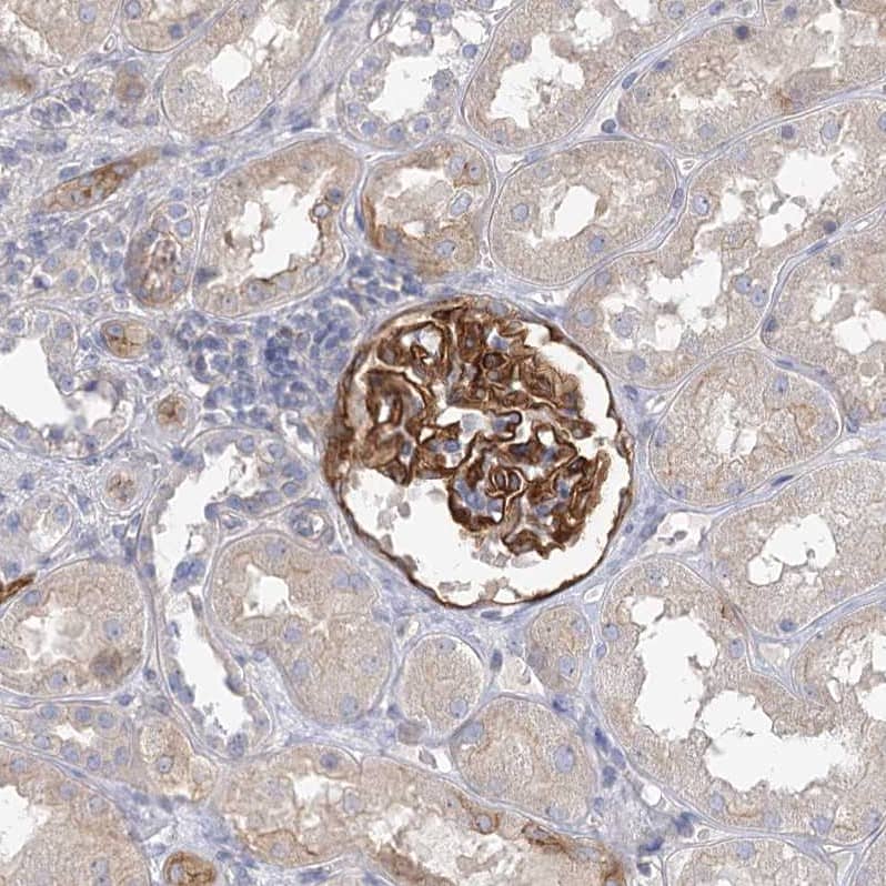 Staining of human kidney shows strong cytoplasmic positivity in cells in glomeruli.