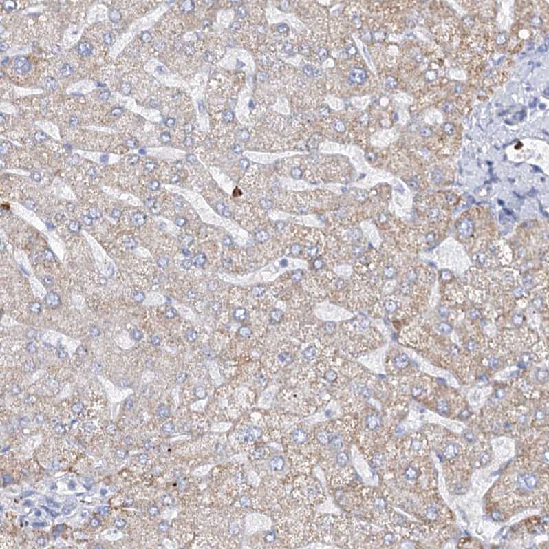 Staining of human liver shows  weak cytoplasmic positivity in hepatocytes.